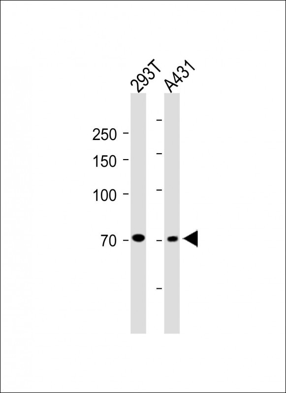 Rabbit Polyclonal Antibody to TNFAIP2