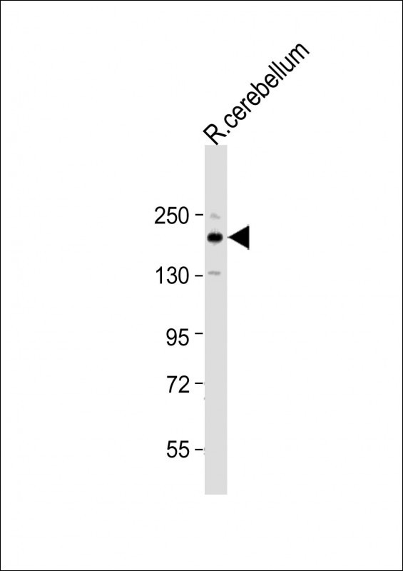Rabbit Polyclonal Antibody to RET (C-term L1027)