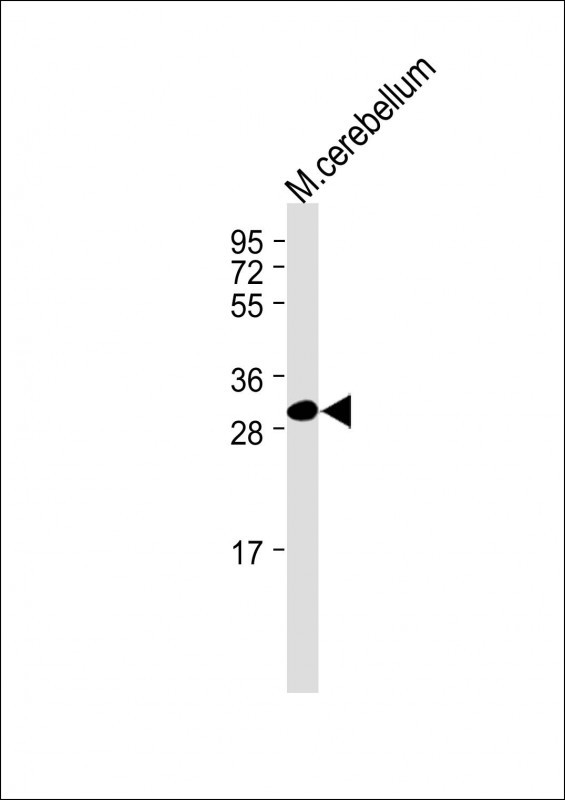 Rabbit Polyclonal Antibody to TMEM66 (N-term)