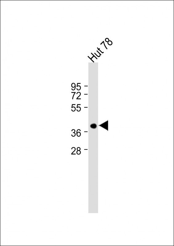 Rabbit Polyclonal Antibody to FUT7 (N-term)