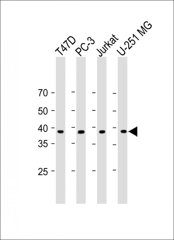 Rabbit Polyclonal Antibody to PSMB11