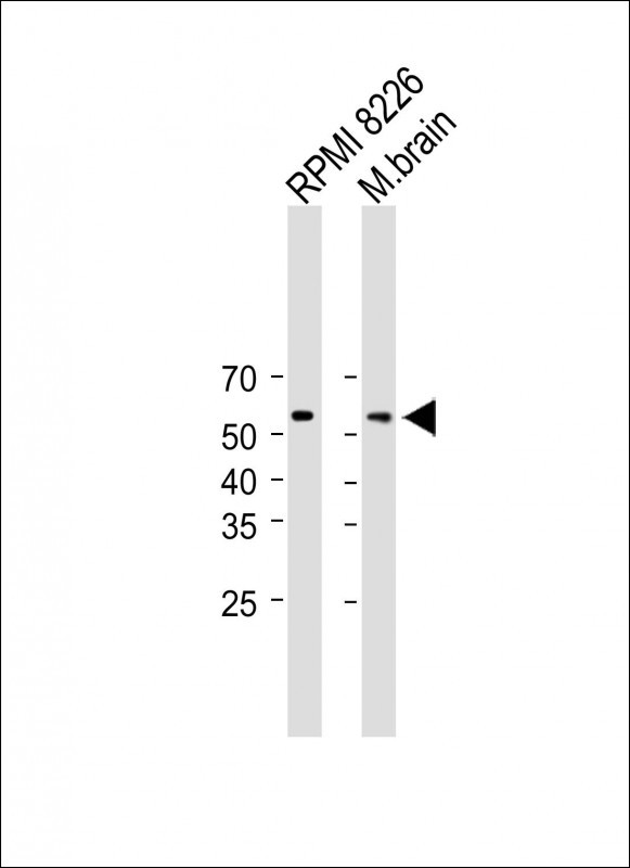 Rabbit Polyclonal Antibody to SMPD3 (N-term)