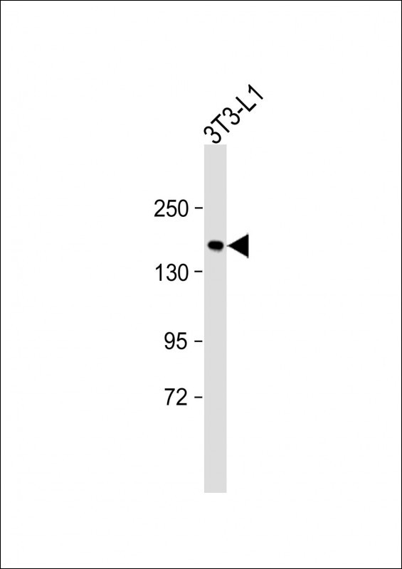 Rabbit Polyclonal Antibody to RECK
