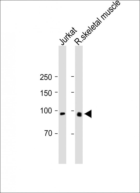 Rabbit Polyclonal Antibody to PDPR