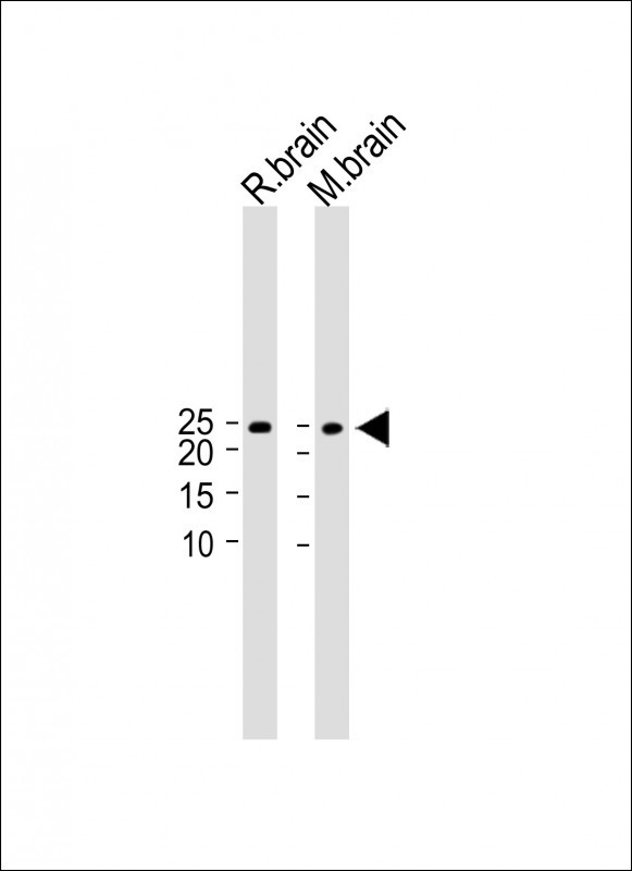 Rabbit Polyclonal Antibody to NKAIN2