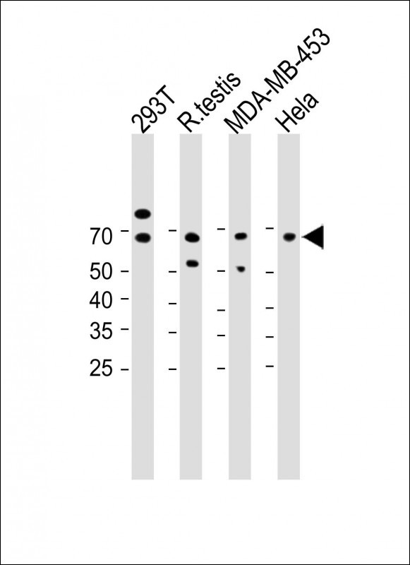 Rabbit Polyclonal Antibody to PTDSS1