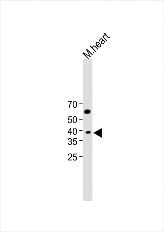 Rabbit Polyclonal Antibody to CH25H (N-Term)