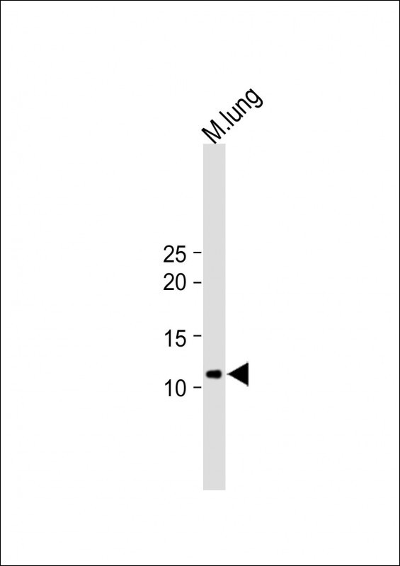 Rabbit Polyclonal Antibody to IFT20