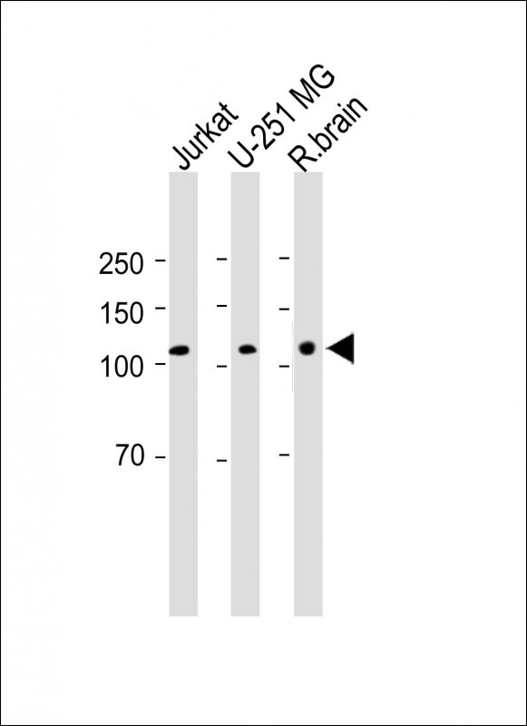 Rabbit Polyclonal Antibody to EphA5