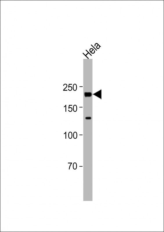 Rabbit Polyclonal Antibody to TOP2A