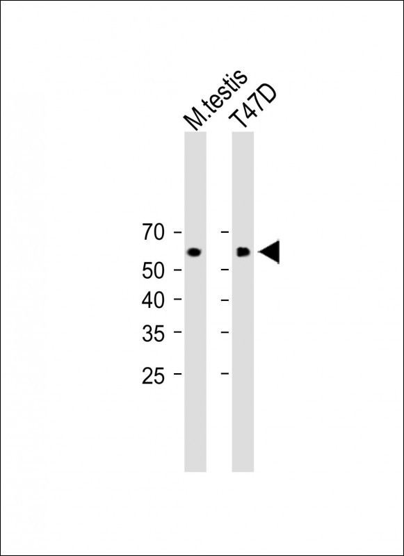 Rabbit Polyclonal Antibody to ENTPD2 (N-term)