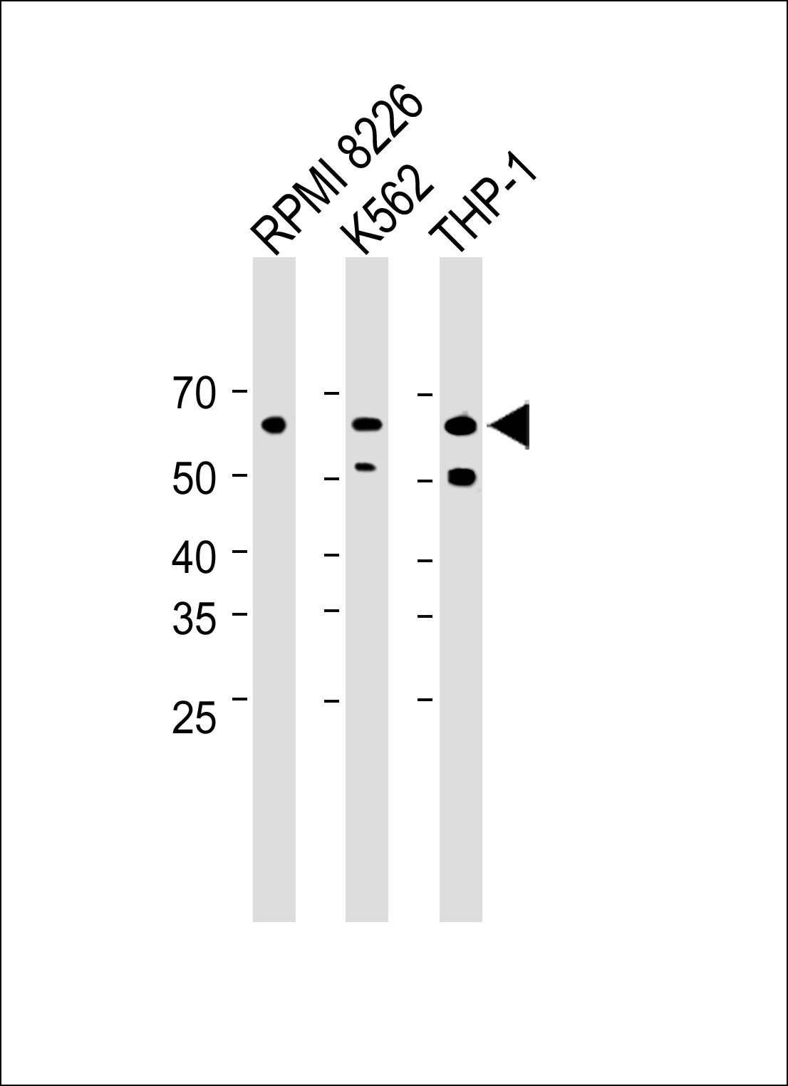 Rabbit Polyclonal Antibody to TCHP
