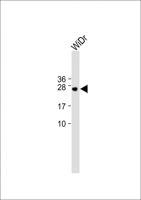 Rabbit Polyclonal Antibody to C9orf95 (N-term)