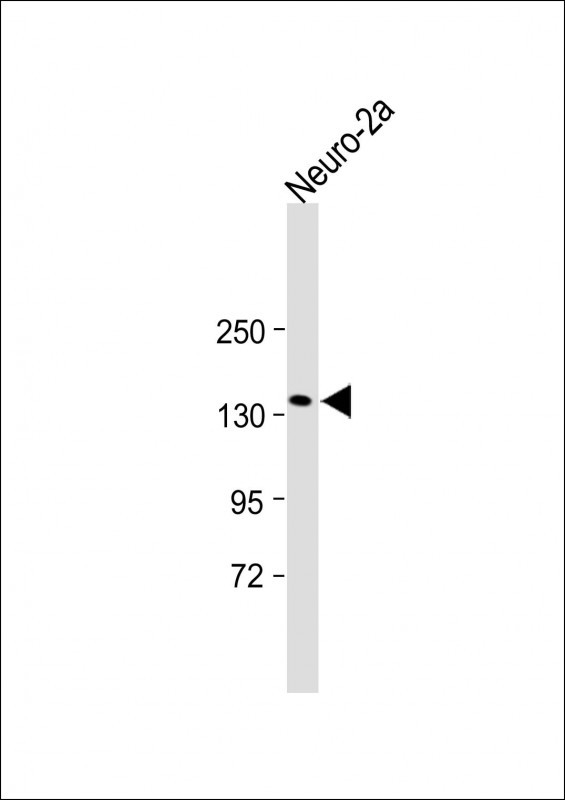 Rabbit Polyclonal Antibody to ITGA11 (N-term)