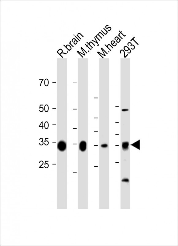 Rabbit Polyclonal Antibody to GPD1L (N-term)