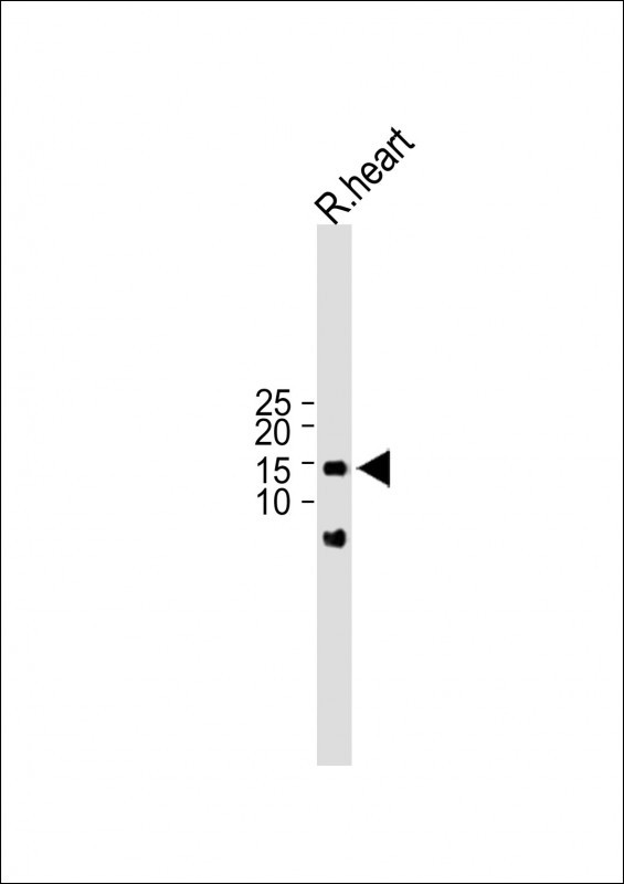 Rabbit Polyclonal Antibody to ISCA2