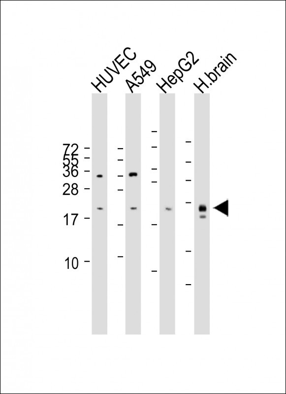 Rabbit Polyclonal Antibody to EDN1