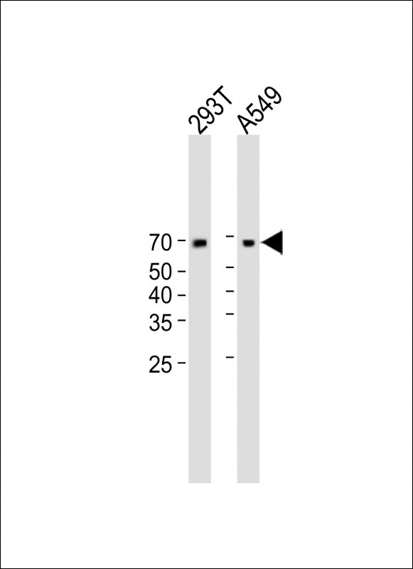 Rabbit Polyclonal Antibody to HERV-FRD (N-term)