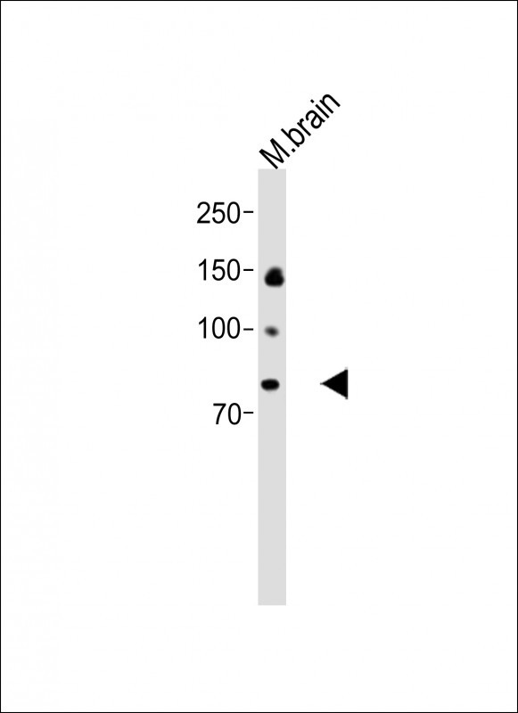 Rabbit Polyclonal Antibody to CAPN8
