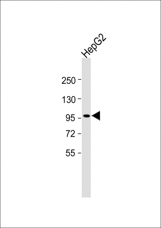 Rabbit Polyclonal Antibody to INTS6 (N-Term)