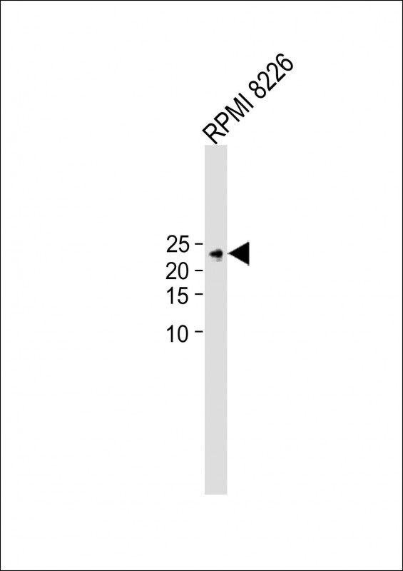 Rabbit Polyclonal Antibody to TIFA (N-term)