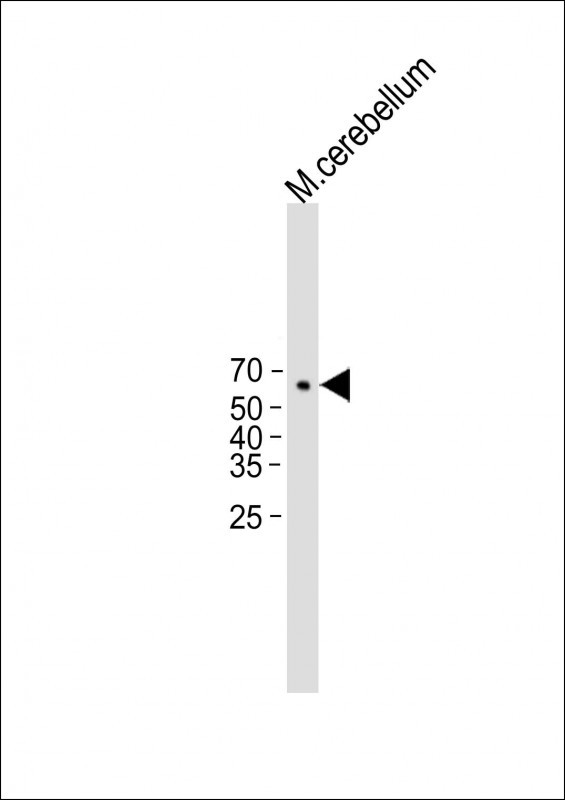 Rabbit Polyclonal Antibody to Mouse Camkk1
