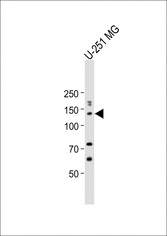 Rabbit Polyclonal Antibody to ZNF516
