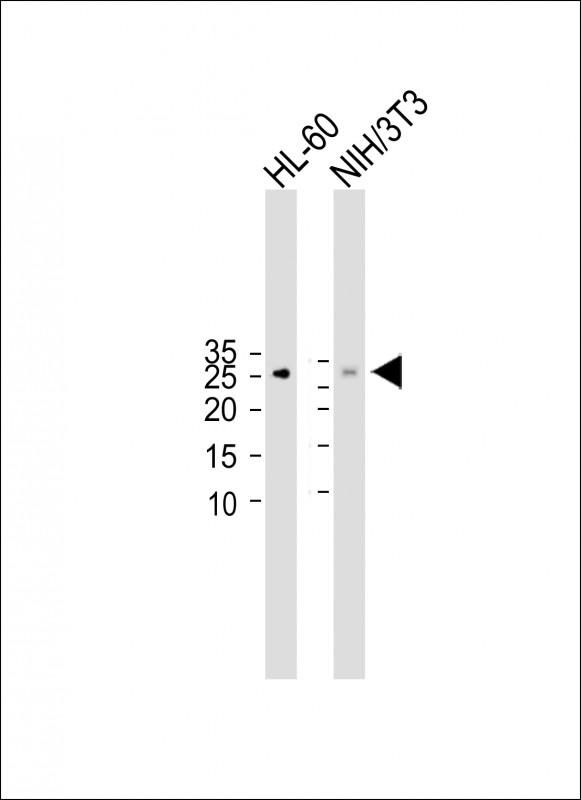 Rabbit Polyclonal Antibody to p27Kip1(S10)