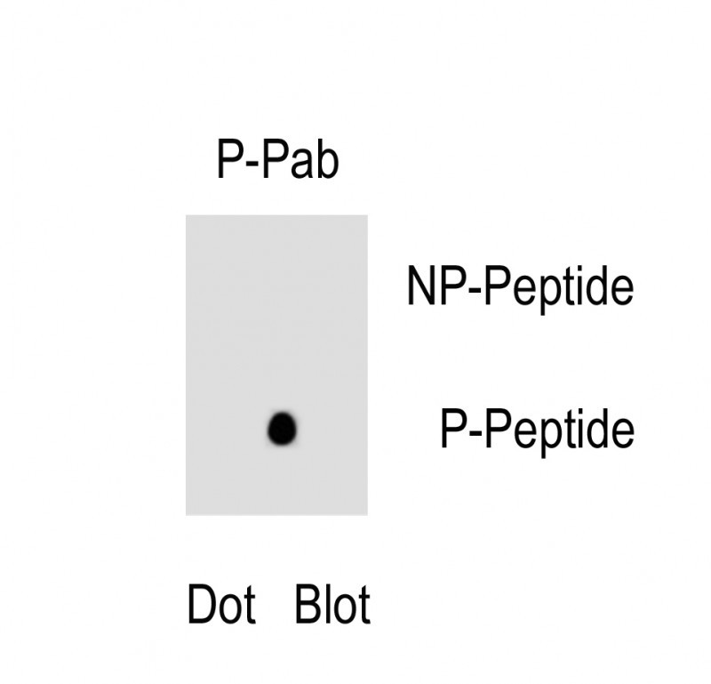 Rabbit Polyclonal Antibody to Phospho-HUMAN-PIK3C2B(Y228)