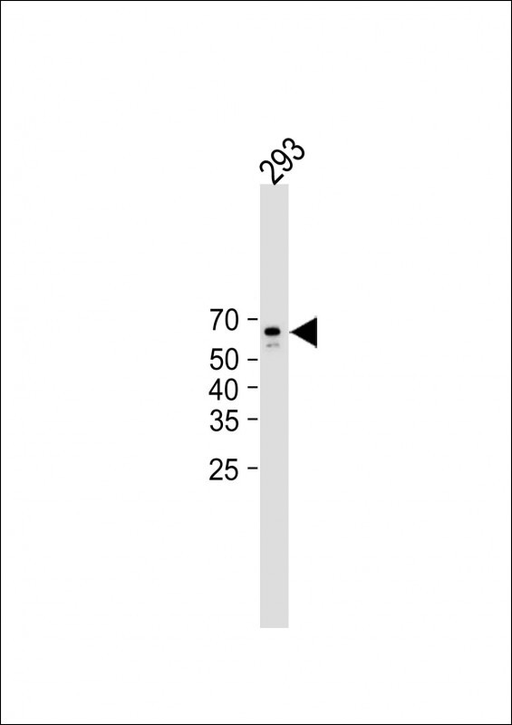 Rabbit Polyclonal Antibody to CAMK2A (CAMK2 alpha)