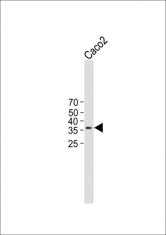 Rabbit Polyclonal Antibody to TMEM150B (N-term)