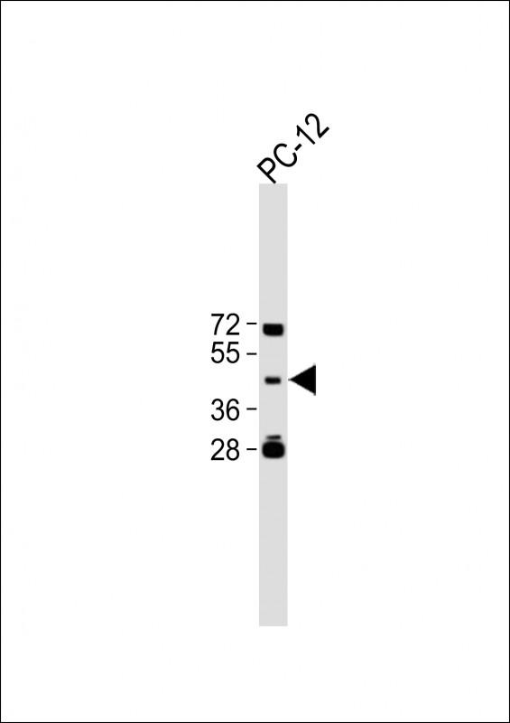 Rabbit Polyclonal Antibody to TBC1D13