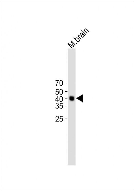 Rabbit Polyclonal Antibody to PURB