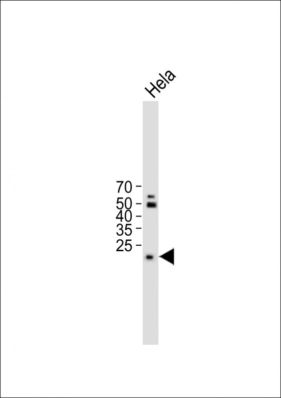 Rabbit Polyclonal Antibody to TM4SF1 (N-term)