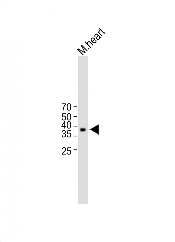 Rabbit Polyclonal Antibody to CTGF