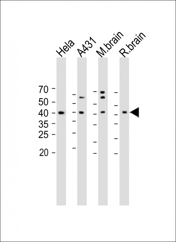 Rabbit Polyclonal Antibody to ACTG2