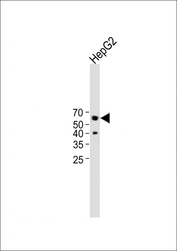 Rabbit Polyclonal Antibody to Connexin 50 (N-term)