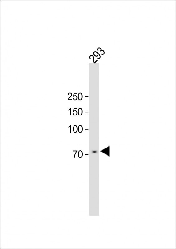 Rabbit Polyclonal Antibody to PHEX
