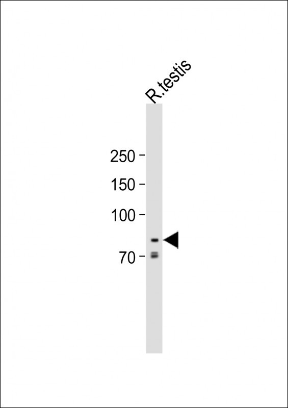 Rabbit Polyclonal Antibody to USP51