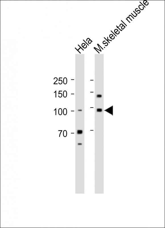 Rabbit Polyclonal Antibody to Mouse Fgfr4