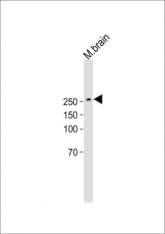 Rabbit Polyclonal Antibody to SPTBN1
