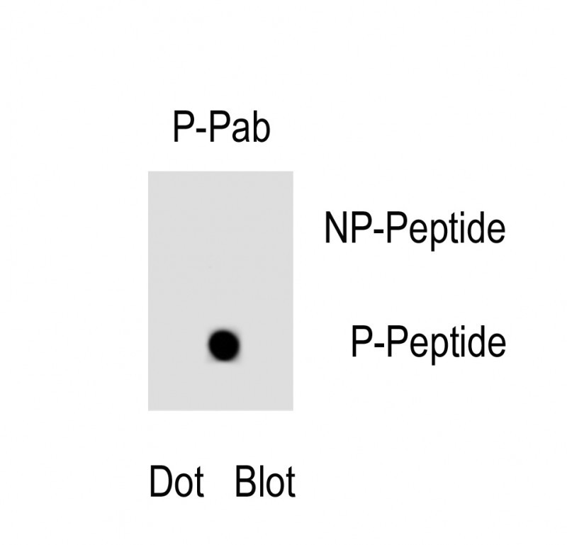 Rabbit Polyclonal Antibody to Phospho-FAS(Y291)