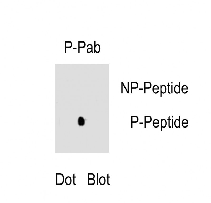 Rabbit Polyclonal Antibody to Phospho-RUNX2(S465)