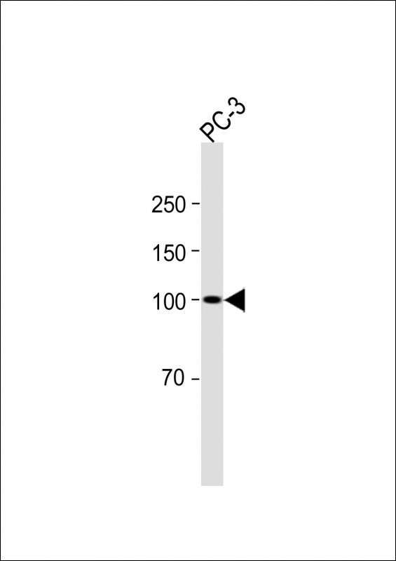 Rabbit Polyclonal Antibody to Parp9