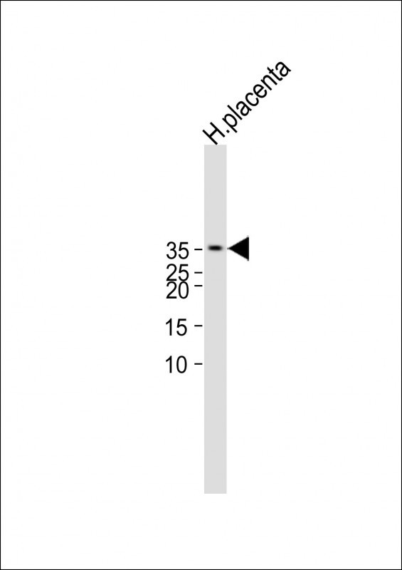 Rabbit Polyclonal Antibody to CGB/HCG-Beta