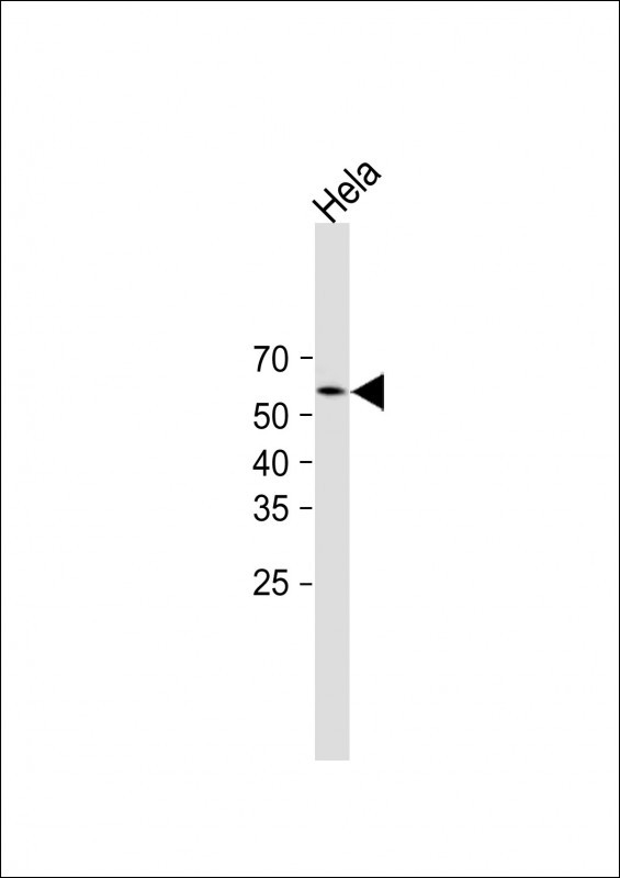 Rabbit Polyclonal Antibody to Parkin