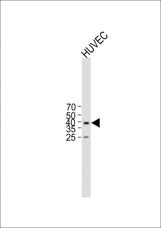 Rabbit Polyclonal Antibody to SFRP2