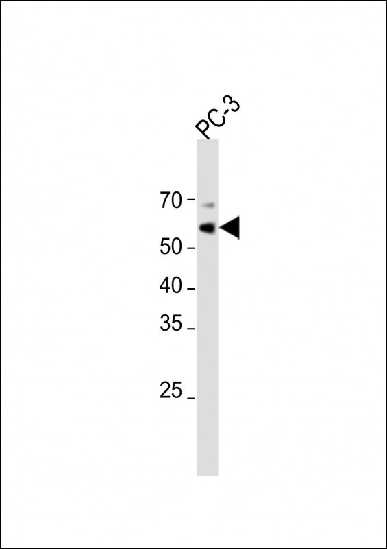 Rabbit Polyclonal Antibody to SPAM1