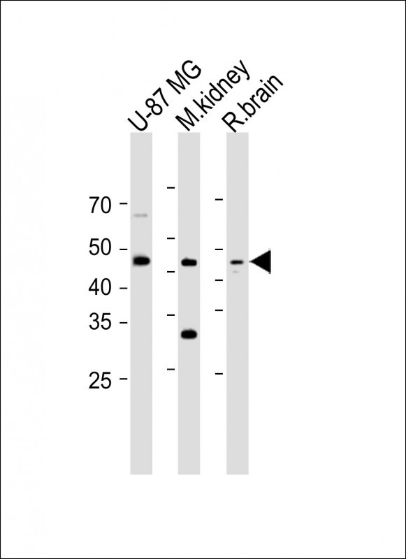 Rabbit Polyclonal Antibody to STAC2(N-term)