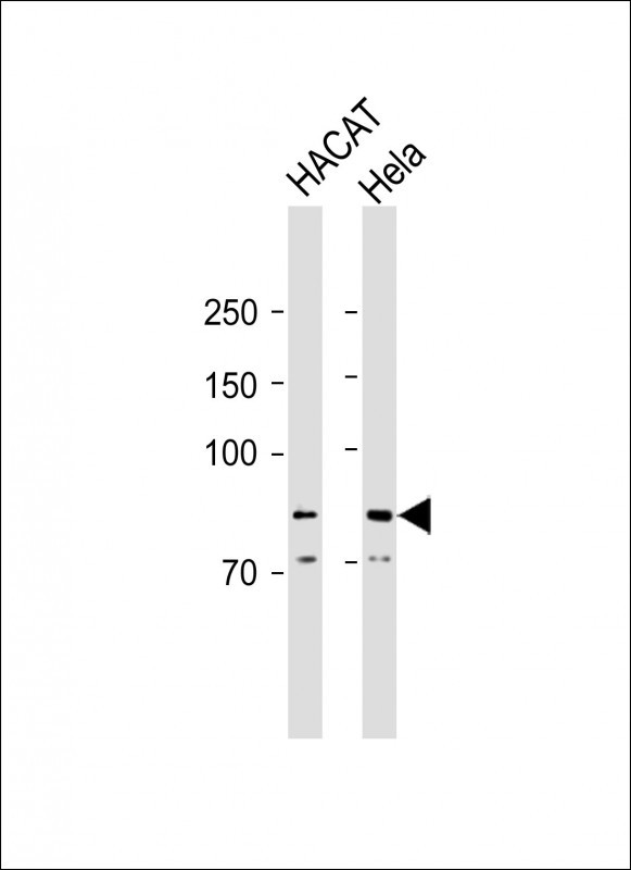 Rabbit Polyclonal Antibody to ALOX12B